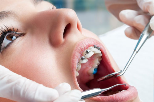 How to Choose the Right Orthodontic Treatment